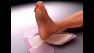 Application of ALLEVYN Gentle Border Heel Dressing to the Heel [upl. by Phillips]