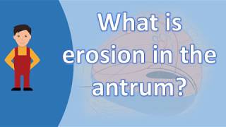 What is erosion in the antrum   Best and Top Health FAQs [upl. by Johnstone]