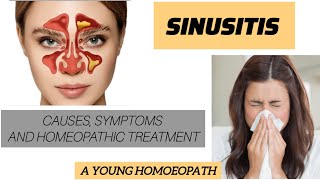 SINUSITIS Causes symptoms and Homeopathic treatment  A YOUNG HOMOEOPATH [upl. by Ecertap]