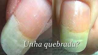 Unha quebrada aprenda como recuperar  Faça você mesma [upl. by Aitnwahs670]