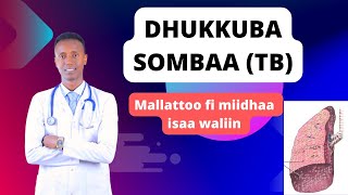 Mallattoo fi miidhaa dhukkuba Sombaa TB  Dr Abdulhakim shamsudin [upl. by Aztilay]