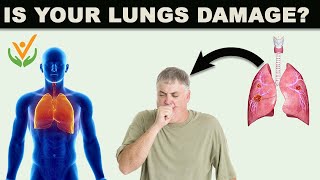 Are You Know About This Chronic Lungs Disease [upl. by Lissa]