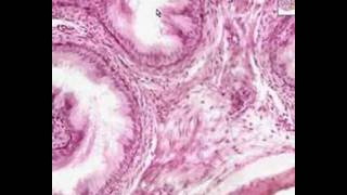 Shotgun Histology Epididymis [upl. by Nnylasor380]