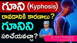 What is Kyphosis Can Kyphosis be corrected  I Kyphosis I scoliosis treatment I Dr GPV Subbaiah [upl. by Alel470]