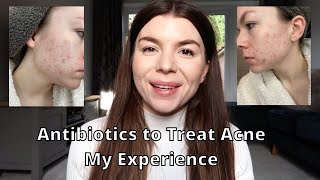 My Experience on Antibiotics for Acne erythromycin and doxycycline Did They Work My Acne Journey [upl. by Oniskey]