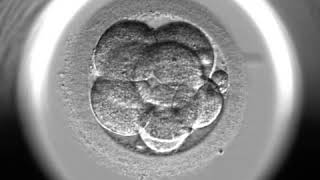 Embryoscope time lapse system [upl. by Enoval]