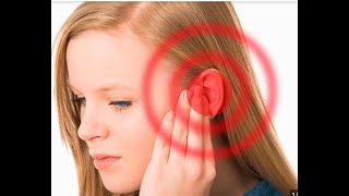 Imaging of Pulsatile Tinnitus [upl. by Sida]