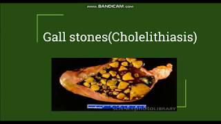 Cholelithiasis  Gallstones Pathogenesis amp Morphology [upl. by Batty]