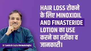 Minoxidil and Finasteride lotion का use करने का तरीका व जानकारी। Hair Specialist Dr Sandesh Gupta [upl. by Brainard584]