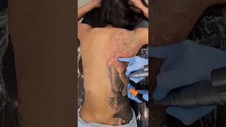 Tattoo Removal😱 [upl. by Aneri]