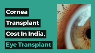 Cornea Transplant in India Eye Transplant Cost in India [upl. by Kenwee277]