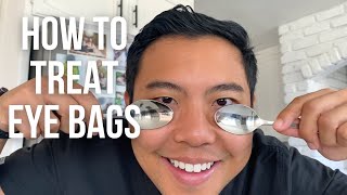 How to get rid of UNDER EYE BAGS FAST the SAFEST ways  👁 Ophthalmologist michaelchuamd [upl. by Nnaitak]