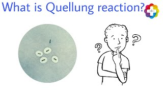 Complete detail ppt on Quellung reaction medicaleducation medicallife [upl. by Parry111]