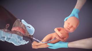 from fertilization to childbirth 3d medical animation by Dandelion Team [upl. by Delphina]