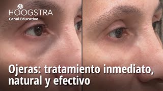 Ojeras tratamiento inmediato natural y efectivo  24130 [upl. by Odlanor]