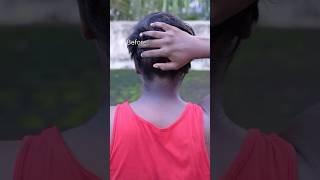 Neck Cleaning Tips  Dark Neck Remove Home RemediesGet Rid Of Dark Neck dark shorts viralvideo [upl. by Lewiss]