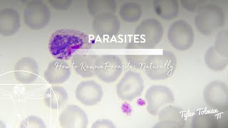 How to Remove Parasites Naturally [upl. by Gintz]