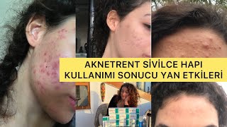 AKNETRENT SİVİLCE TEDAVİ SÜRECİM NELER YAŞADIM YAN ETKİLERİ NE OLDU  AKNE ROACCUTANE SİVİLCE [upl. by Gnilrits701]