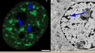 mRNA amp miRNA Lecture [upl. by Annodam763]