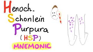 HenochSchönlein Purpura HSP  with a Mnemonic [upl. by Polik]