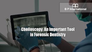 Cheiloscopy An Important Tool in Forensic Dentistry [upl. by Nirel]