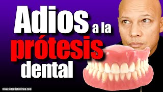 LA MEJOR FORMA de REEMPLAZAR TU PROTESIS DENTAL sin TENER MUCHO HUESO en las ENCÍAS [upl. by Iur]