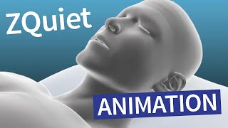 ZQuiet Orthèse antironflement – Animation [upl. by Fidela]