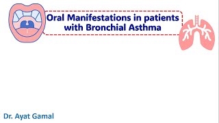 Oral manifestations of bronchial asthma amp medication modifications [upl. by Rehtaeh]