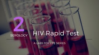 HIV Rapid Test [upl. by Lirrad]