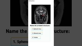 🔍 Anatomy Quiz🔍 Comment your answer belowRadiologyBuzz SinusAnatomy RadiologyQuiz [upl. by Stacy]