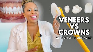 Veneers vs Crowns Whats Better For Your Smile [upl. by Moorefield]