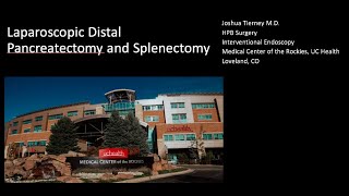 Laparoscopic distal pancreatectomy with splenectomy [upl. by Bury434]