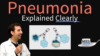 Pneumonia Explained Clearly by MedCramcom [upl. by Ainala723]