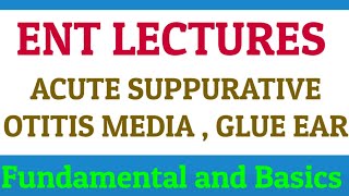 Acute Suppurative Otitis Media  ASOM  GLUE EAR  ENT LECTURES [upl. by Arley324]