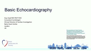 Basic Echocardiography Review echocardiogram [upl. by Anselmo882]