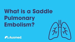 What is a Saddle Pulmonary Embolism PE  Ausmed Explains [upl. by Riannon208]