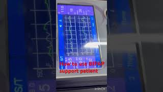 How to use bipap machine  BIPAP support icu patient  BIPAP setup icu patient  bipap shorts [upl. by Anaib]