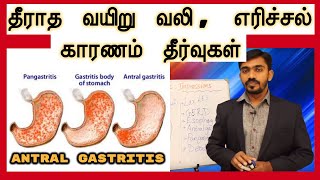 தீராத வயிறு வலி எரிச்சல் காரணம் தீர்வுகள் மிக எளிமையாக l ANTRAL GASTRITIS REASONS AND CURE IN TAMIL [upl. by Phyllida]