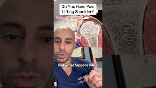 Pain When Lifting Shoulder Doctor Explains [upl. by Keyser235]