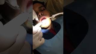 💥🤯 பல்ல வெள்ளையாக்கலாம்⁉️😬  Teeth Whiting treatment🦷 shorts ashortaday tamilvlog [upl. by Ynots]