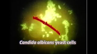 Candida albicans under Fluorescence microscope stained with Acridine Orange [upl. by Perla608]