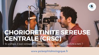 Choriorétinite séreuse centrale CRSC Pole Ophtalmologique [upl. by Anayek]