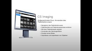 CS Imaging Aufgezeichneter Kurs Anwenden des Patientenbrowsers [upl. by Papageno]