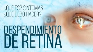 Desprendimiento de retina [upl. by Grethel]