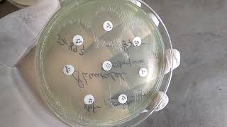 Pseudomonas aeruginosa antimicrobial sensitivity testing  ASTantibiotics uses according to CLSI [upl. by Anawqahs]