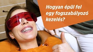 Fogszabályozó kezelés kezdeti lépései az Optimum Fogászatnál [upl. by Hendrix]