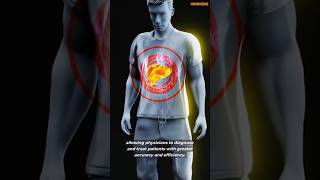 Revolutionizing Diagnostics Holography in Medical Imaging medicalbreakthroughs [upl. by Aerdnas43]