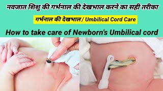 Newborn Baby ki garbhnal ki dekhbhal kaise kre। नवजात शिशु की गर्भनालनाभि का ध्यान कैसे रखें। [upl. by Nalepka]