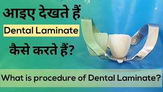 Dental Laminate l आइए देखते हैं Dental Laminate कैसे करते हैं [upl. by Atires]