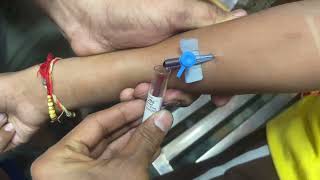 Intravenous Cannulation  iv cannula fixing  blood collection using by cannula  iv vigo [upl. by Lebaron]